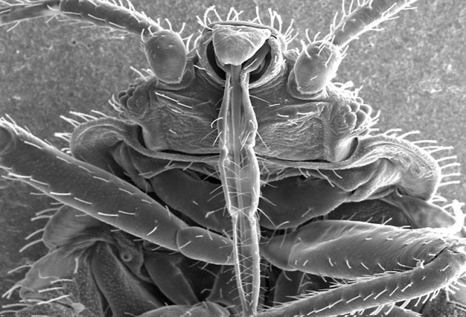 全米で猛威を振るう「Bed Bug（南京虫）」の被害に遭ったときの対処法とは？
